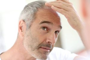 ریزش مو با افزایش سن