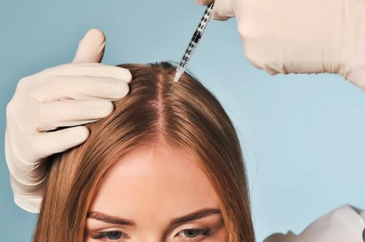 بوتاکس و مزوتراپی بعد از کاشت مو