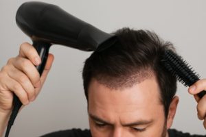 استفاده از سشوار و اتو مو بعد از کاشت