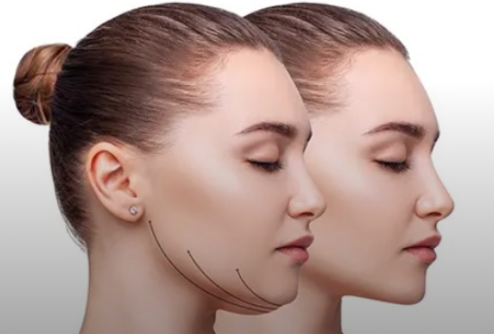 آیا چاق شدن دوباره باعث بازگشت چربی بوکال می‌شود؟