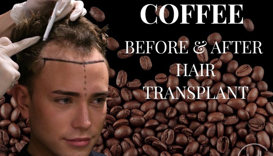 تأثیر مصرف کافئین بر رشد موهای کاشته‌شده