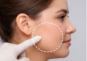 بوکال فت صورت گرد