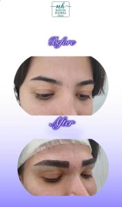 نمونه کار کاشت ابرو نوین همسا