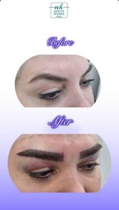 نمونه کار کاشت ابرو نوین همسا