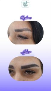 نمونه کار کاشت ابرو نوین همسا