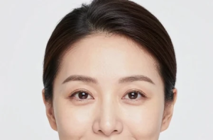 بهترین کاندیدای جراحی پلک (بلفاروپلاستی)