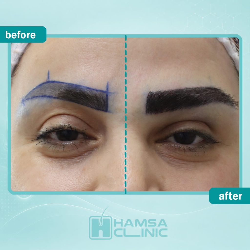 eyebrow6