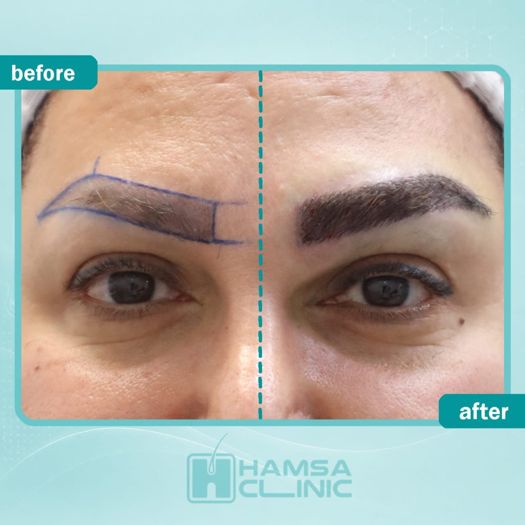 eyebrow4