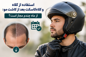 استفاده از کلاه و کلاه‌کاسکت بعد از کاشت مو از ماه چندم مجاز است؟