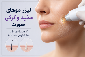 لیزر موهای کرکی